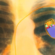 Illustration for article titled A virus that reprograms your pacemaker to deliver an electric shock